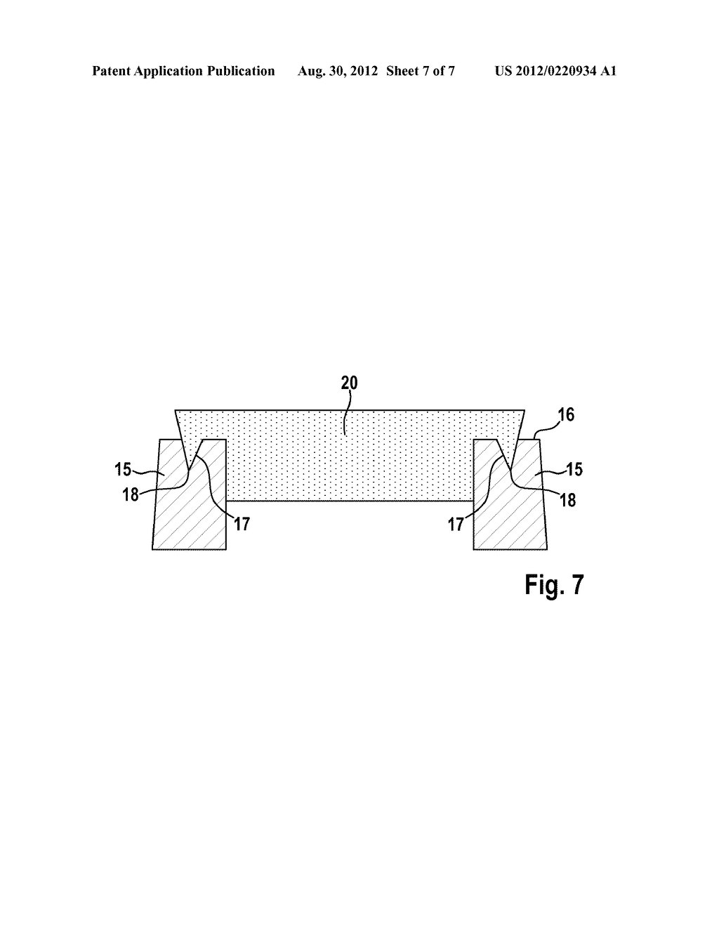 IMPLANT AND METHOD FOR MANUFACTURING SAME - diagram, schematic, and image 08