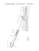 Medical Component Insertion Device Including a Retractable Needle diagram and image