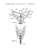 CANNULA DEVICE diagram and image