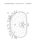 DRESSING ASSEMBLIES FOR WOUND TREATMENT USING REDUCED PRESSURE diagram and image