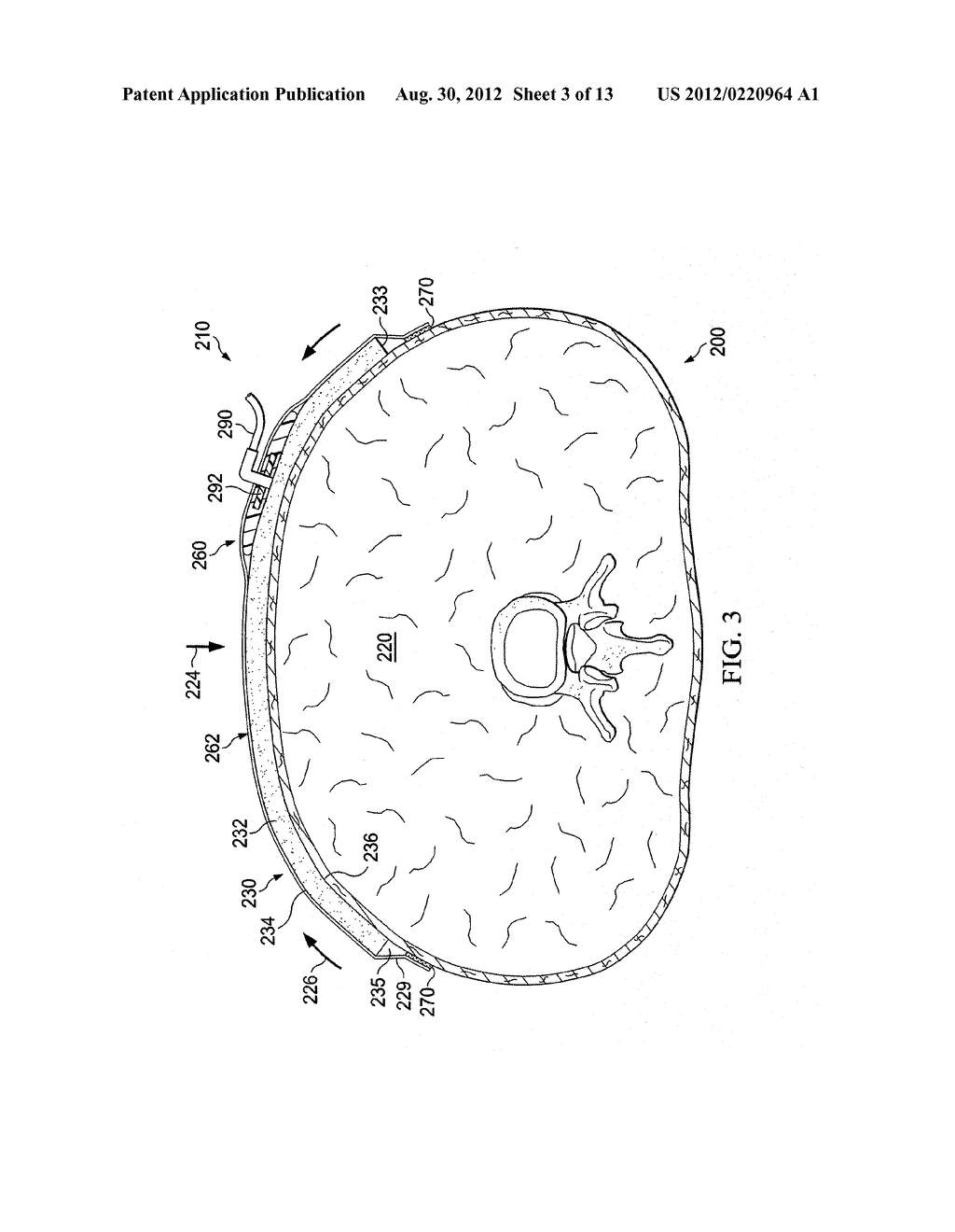 DRESSING ASSEMBLIES FOR WOUND TREATMENT USING REDUCED PRESSURE - diagram, schematic, and image 04