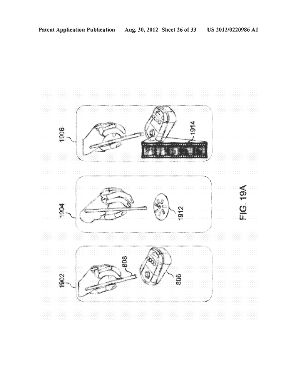 DEVICES AND METHODS FOR INTRAORAL CONTROLLED DRUG RELEASE - diagram, schematic, and image 27