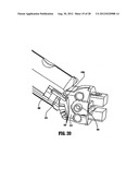 Surgical Instrument Having A Plastic Surface diagram and image