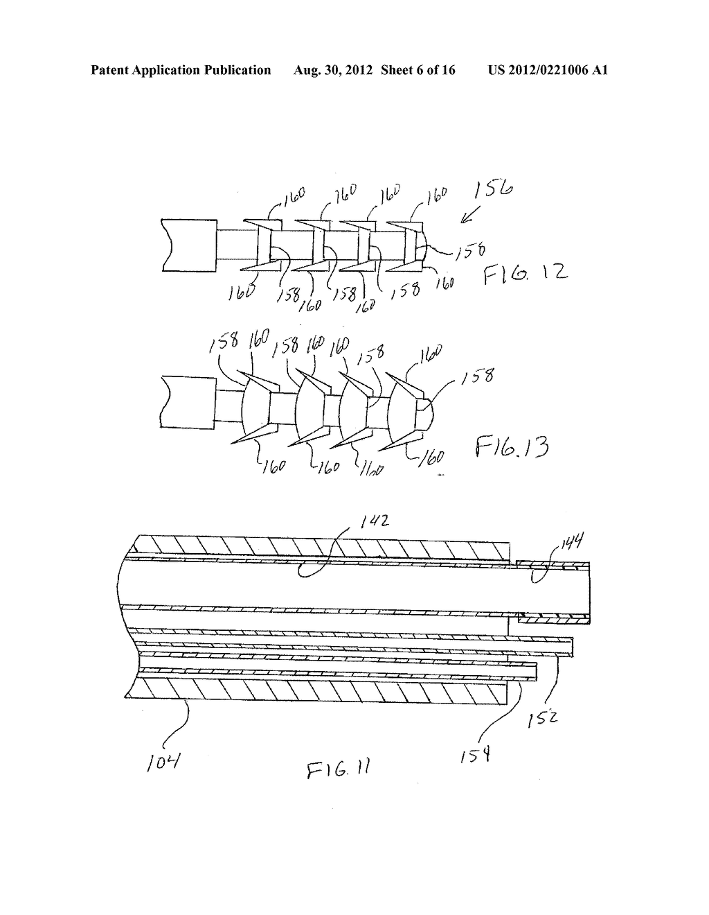 Method for Manipulating Intervertebral Tissue - diagram, schematic, and image 07