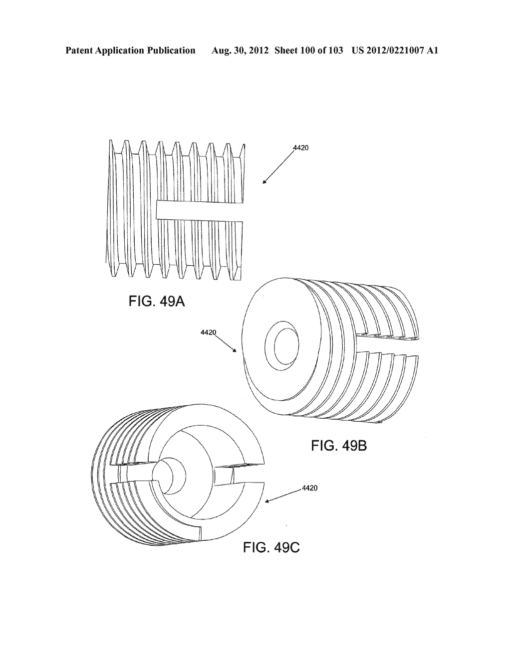 ARTICULATING TISSUE REMOVAL SYSTEMS AND METHODS - diagram, schematic, and image 101