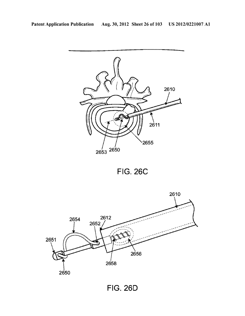 ARTICULATING TISSUE REMOVAL SYSTEMS AND METHODS - diagram, schematic, and image 27