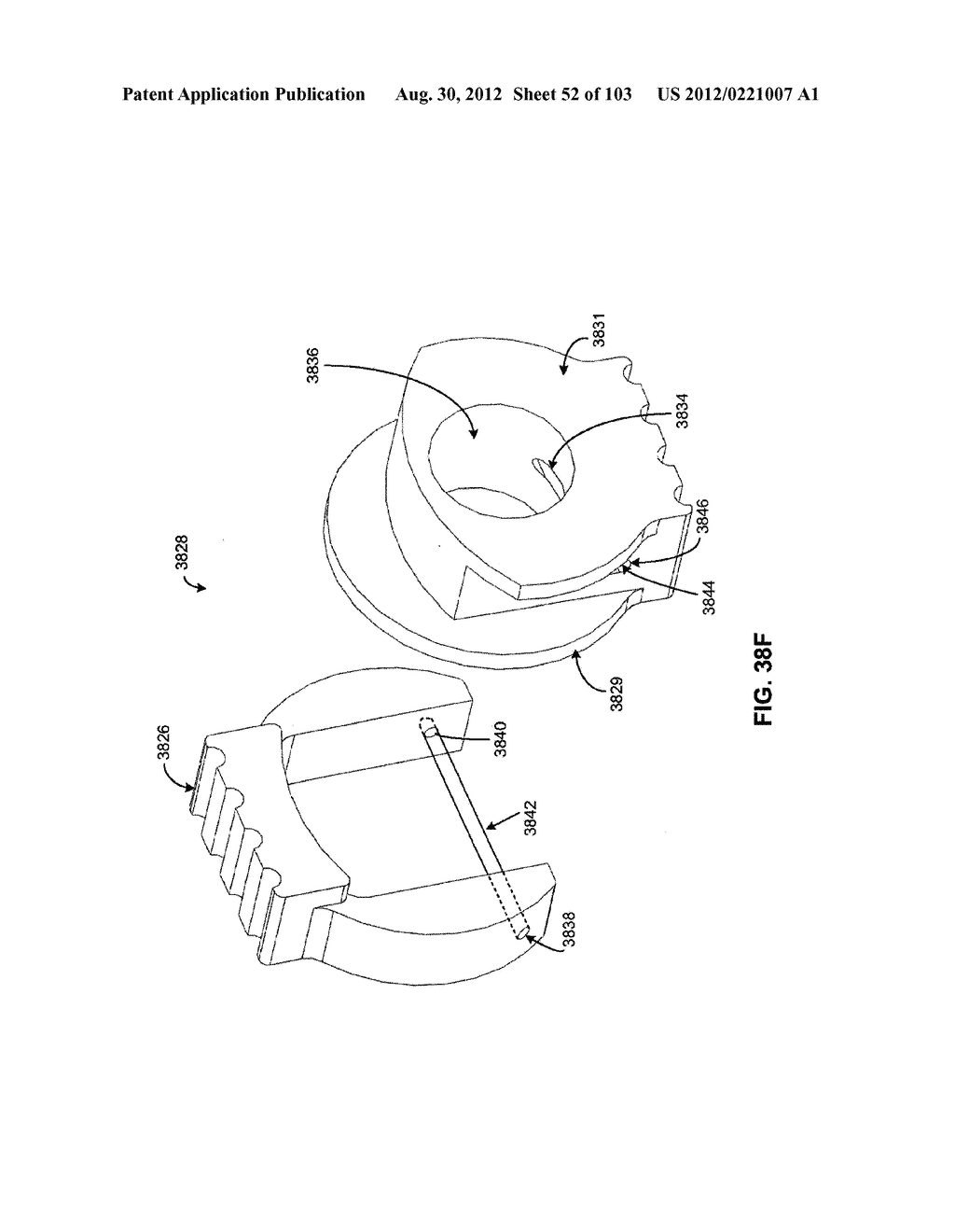 ARTICULATING TISSUE REMOVAL SYSTEMS AND METHODS - diagram, schematic, and image 53