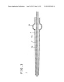 MEDICAL DEVICE AND VASCULARIZATION METHOD diagram and image