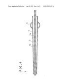 MEDICAL DEVICE AND VASCULARIZATION METHOD diagram and image