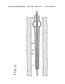 MEDICAL DEVICE AND VASCULARIZATION METHOD diagram and image