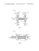 Spinous Process Fusion Devices diagram and image