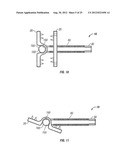 Spinous Process Fusion Devices diagram and image