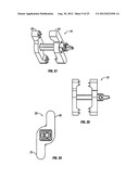 Spinous Process Fusion Devices diagram and image