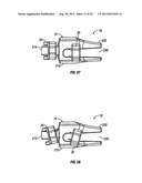 Spinous Process Fusion Devices diagram and image