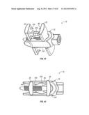 Spinous Process Fusion Devices diagram and image