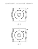 Spinous Process Fusion Devices diagram and image