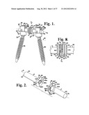 Soft stabilization assemblies with pretensioned cords diagram and image