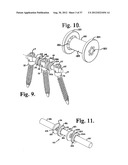 Soft stabilization assemblies with pretensioned cords diagram and image