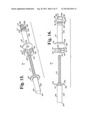 Soft stabilization assemblies with pretensioned cords diagram and image