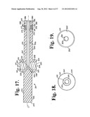 Soft stabilization assemblies with pretensioned cords diagram and image