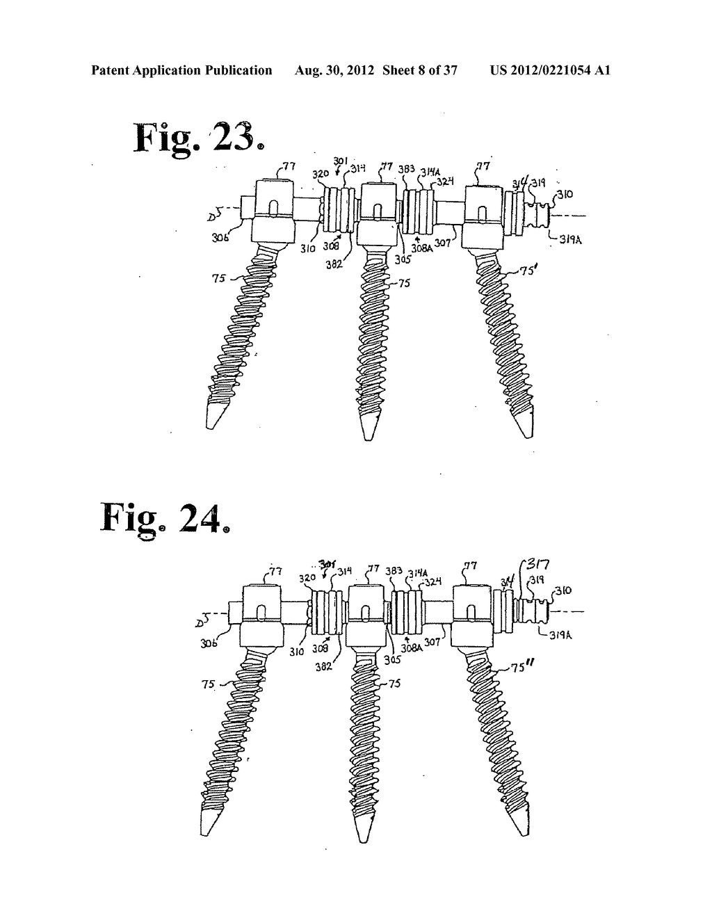 Soft stabilization assemblies with pretensioned cords - diagram, schematic, and image 09