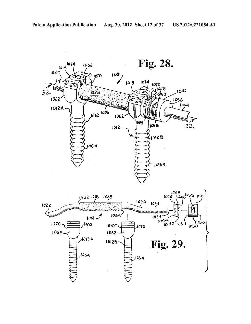 Soft stabilization assemblies with pretensioned cords - diagram, schematic, and image 13