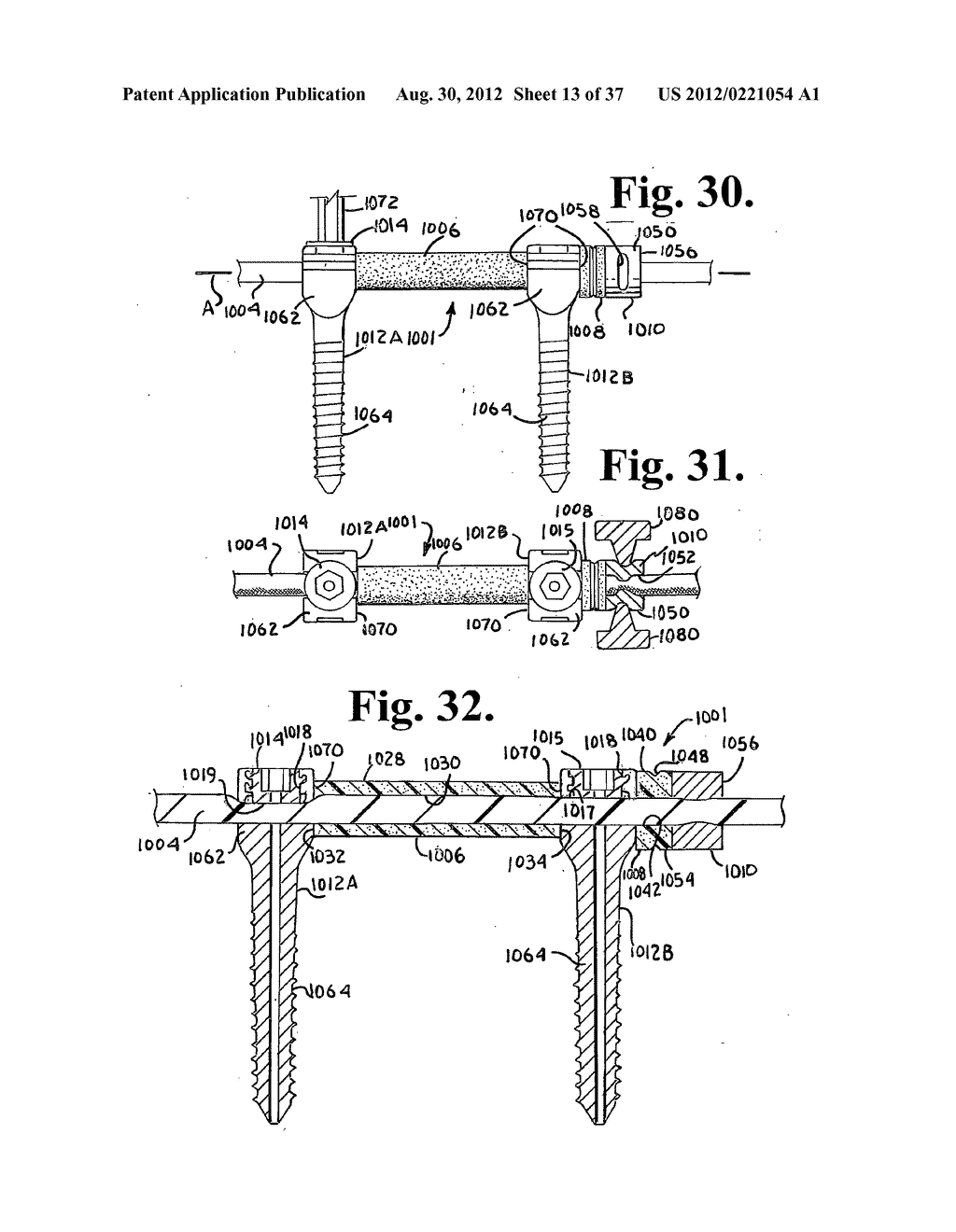 Soft stabilization assemblies with pretensioned cords - diagram, schematic, and image 14