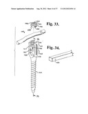 Soft stabilization assemblies with pretensioned cords diagram and image