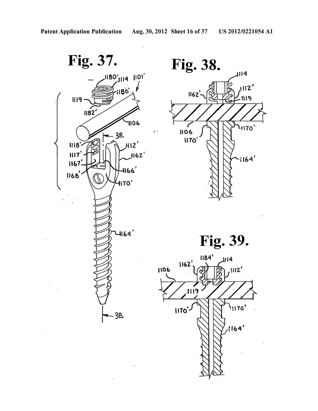 Soft stabilization assemblies with pretensioned cords - diagram, schematic, and image 17