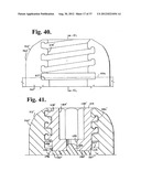 Soft stabilization assemblies with pretensioned cords diagram and image