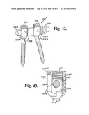 Soft stabilization assemblies with pretensioned cords diagram and image