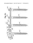 Soft stabilization assemblies with pretensioned cords diagram and image