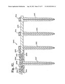 Soft stabilization assemblies with pretensioned cords diagram and image