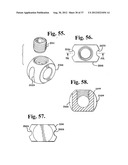 Soft stabilization assemblies with pretensioned cords diagram and image