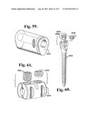 Soft stabilization assemblies with pretensioned cords diagram and image