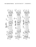 Soft stabilization assemblies with pretensioned cords diagram and image