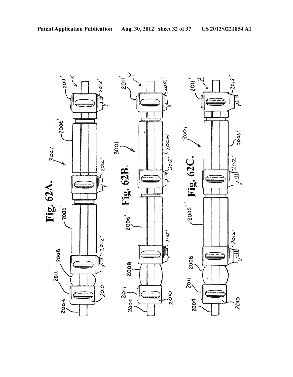 Soft stabilization assemblies with pretensioned cords - diagram, schematic, and image 33