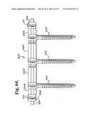 Soft stabilization assemblies with pretensioned cords diagram and image