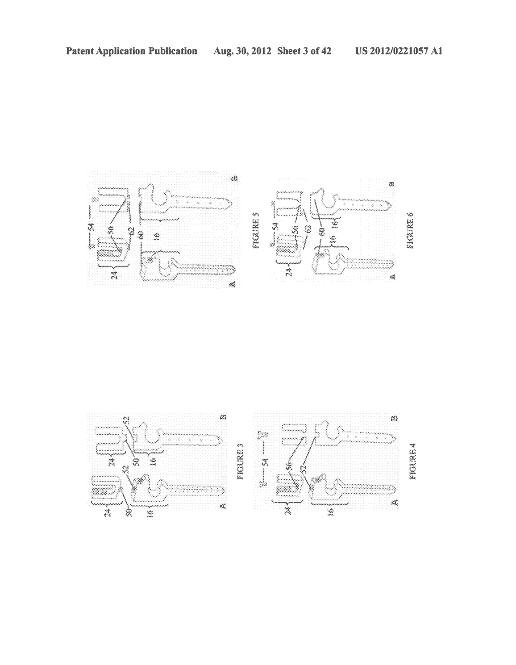 Spinal Rod Link Reducer - diagram, schematic, and image 04