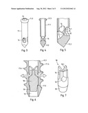 MEDICAL DEVICE, APPARATUS, AND SURGICAL METHOD diagram and image