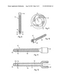 MEDICAL DEVICE, APPARATUS, AND SURGICAL METHOD diagram and image