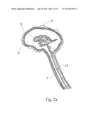 Central Nervous System Treatment Device and Methodology diagram and image