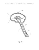 Central Nervous System Treatment Device and Methodology diagram and image