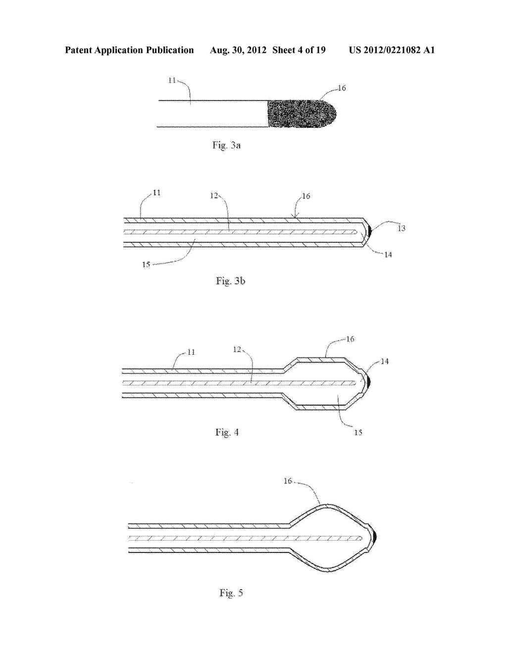 Central Nervous System Treatment Device and Methodology - diagram, schematic, and image 05