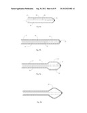 Central Nervous System Treatment Device and Methodology diagram and image