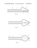 Central Nervous System Treatment Device and Methodology diagram and image