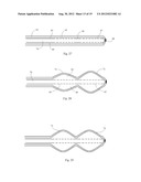 Central Nervous System Treatment Device and Methodology diagram and image