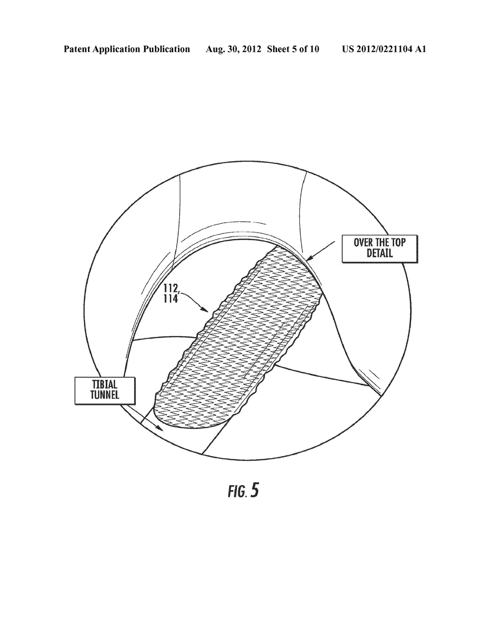 PROSTHETIC DEVICE AND METHOD OF MANUFACTURING THE SAME - diagram, schematic, and image 06