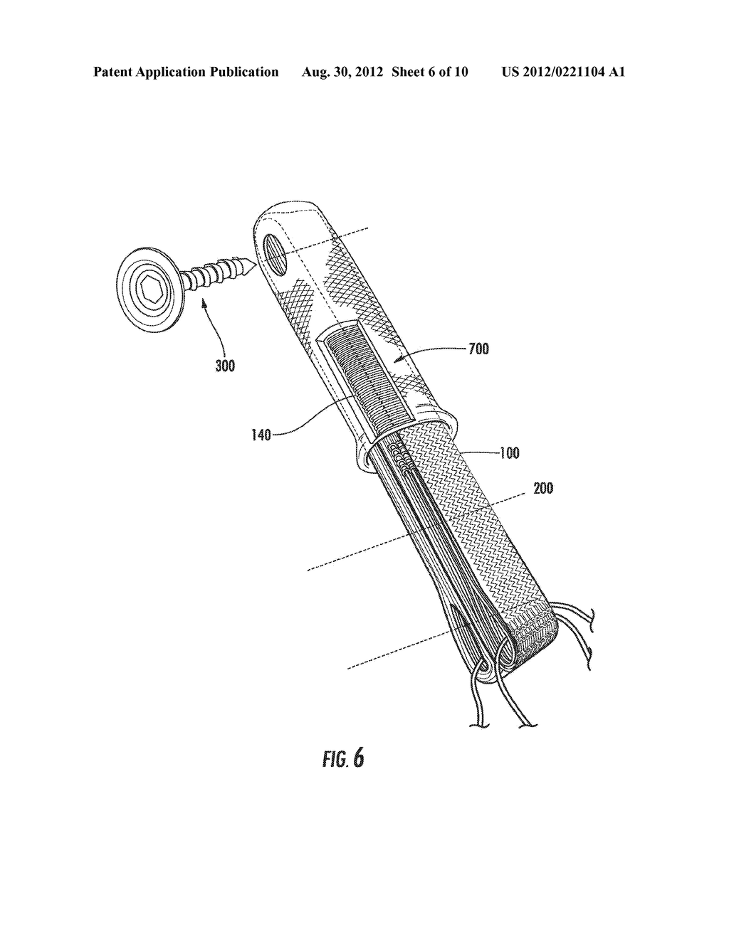 PROSTHETIC DEVICE AND METHOD OF MANUFACTURING THE SAME - diagram, schematic, and image 07