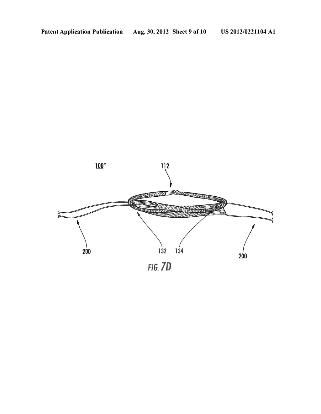 PROSTHETIC DEVICE AND METHOD OF MANUFACTURING THE SAME - diagram, schematic, and image 10